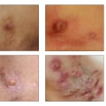 What is primary and secondary diagnosis?