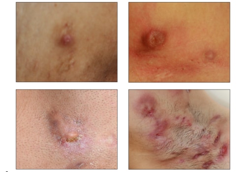 What is primary and secondary diagnosis?